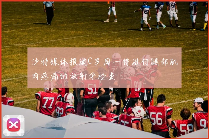 沙特媒体报道C罗周一将进行腿部肌肉疼痛的放射学检查